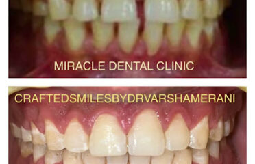 Miracle Health Care Zone   Dental Clinic Viman Nagar  Dentist in Viman Nagar